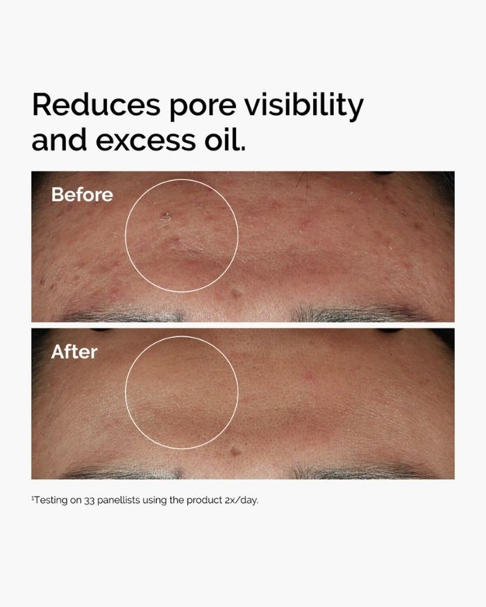 The Ordinary Serum Niacinamide 10% Zinc 1%